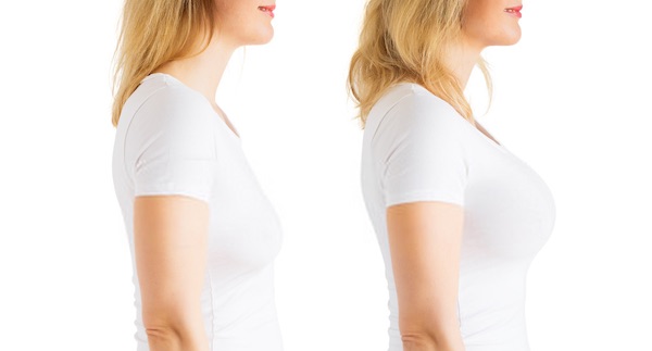 مميزات إجراء عملية تكبير الثدي في تركيا